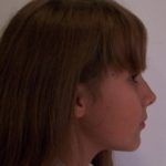 Casos_MariaFernanda_Antes3