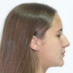 Casos_MariaFernanda_Despues3