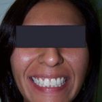 Casos_Mayerlin Bozada_Despues1