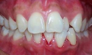 Casos_Mayerlin Bozada_Panoramica_Frontal_Antes1
