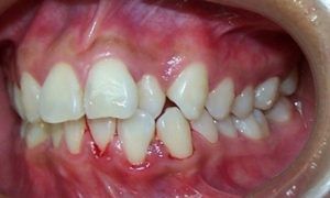 Casos_Mayerlin Bozada_Panoramica_Izq_Antes1