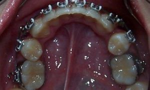 Casos_Mei Cindy_MaxInf_Proceso1