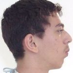 Casos_Quilen Gustavo_Antes3