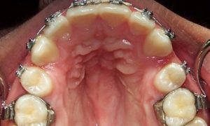 Casos_Quilen Gustavo_MaxSup_Proceso1