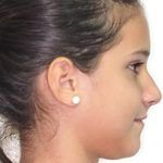 Casos_Steffany Colmenares_Antes3