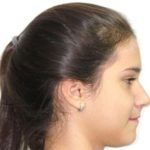 Casos_Steffany Colmenares_Despues3