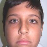 Casos_Quintero Oliver_Antes1