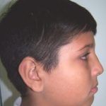 Casos_Quintero Oliver_Antes3