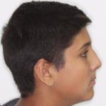 Casos_Quintero Oliver_Despues3