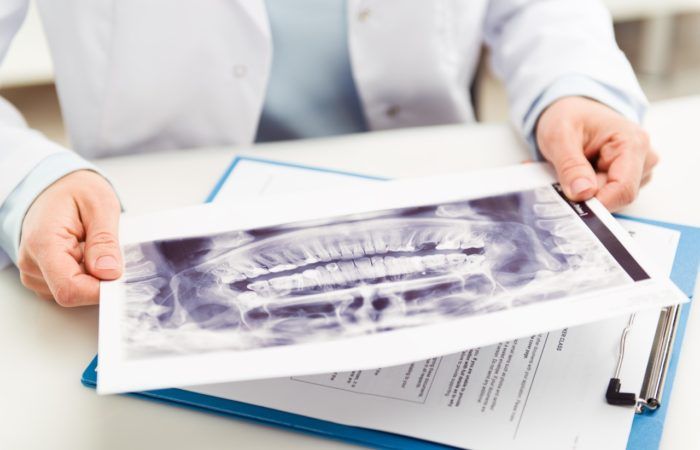 Imagenología dental