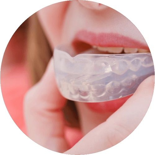 Bruxismo - trastorno dental - BFEsteticaDental - 1