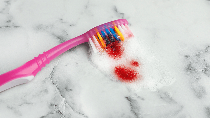 Por qué sangran las encías - Cepillado - BFEstéticaDental
