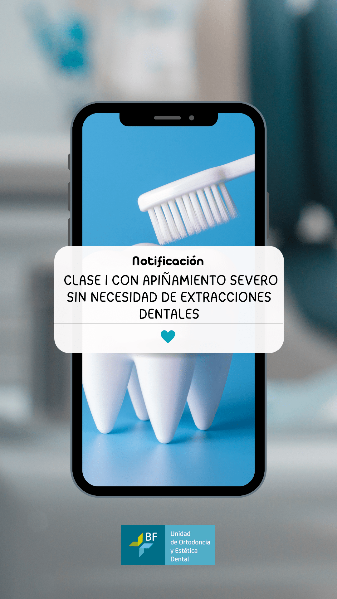 Falta de alineación dental severo