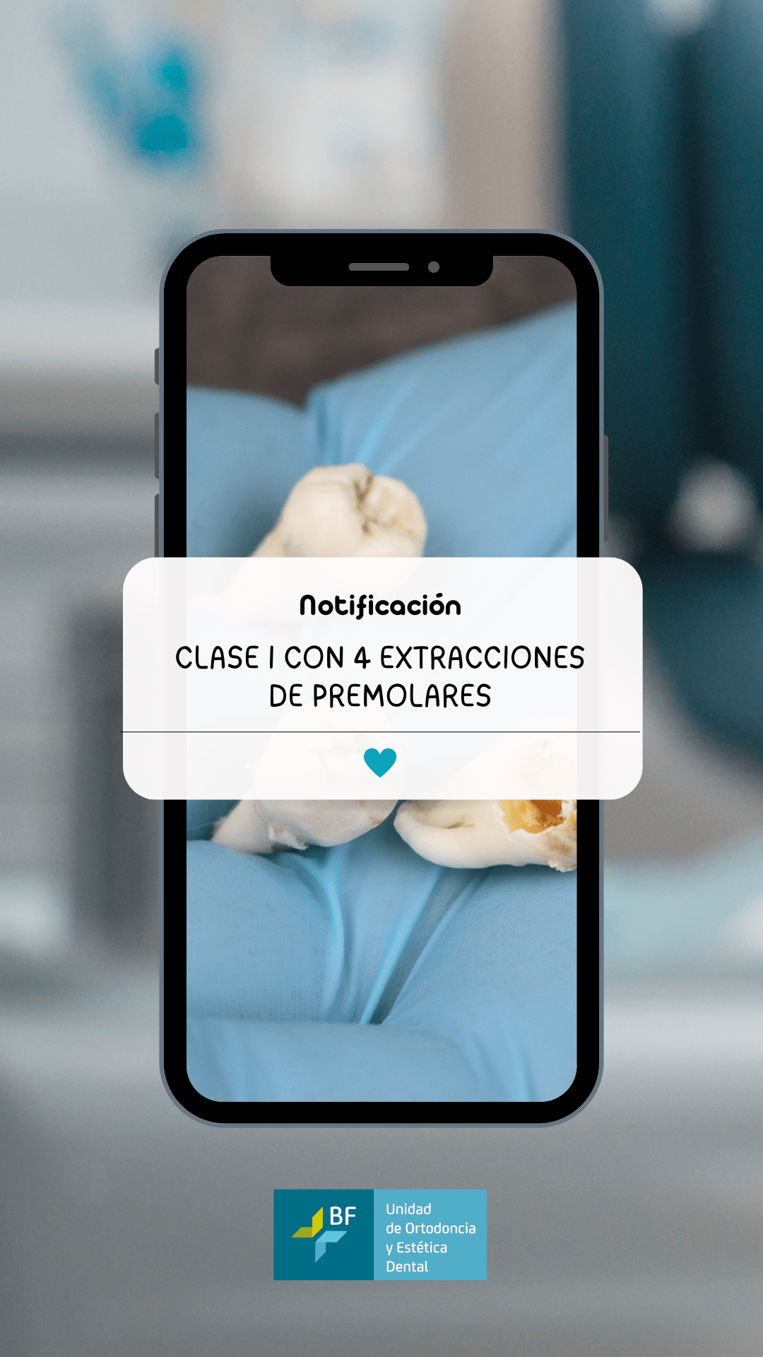 Oclusión Clase I