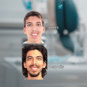 Caso 1